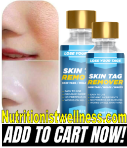 Lose Your Tags Skin Tag Remover Buy Now